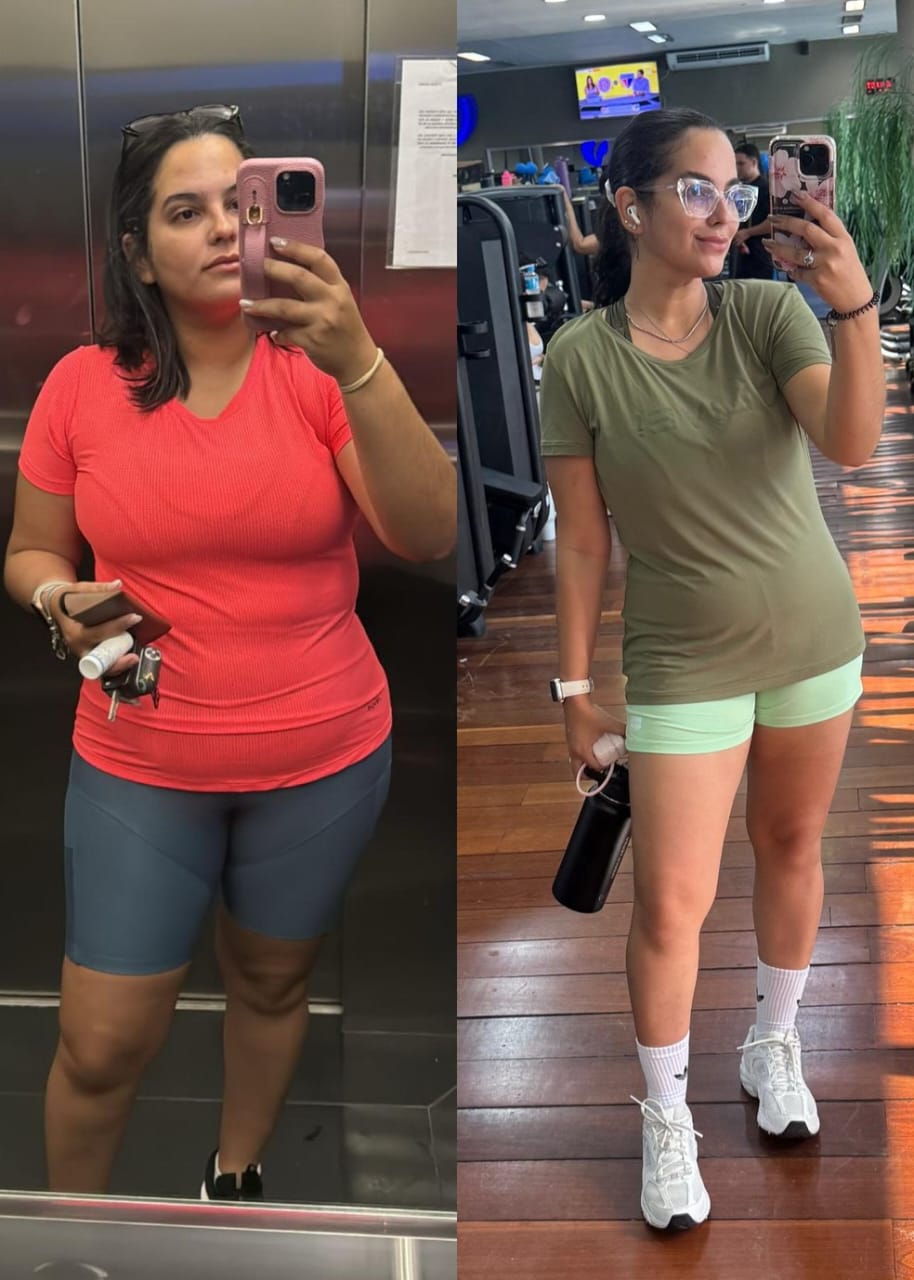 Antes e depois Maria S.